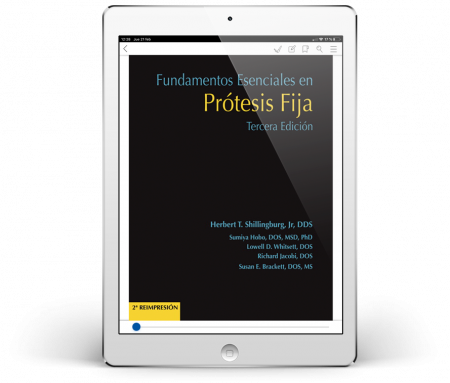 Fundamentos Esenciales en Prótesis Fija (3ª Edición)