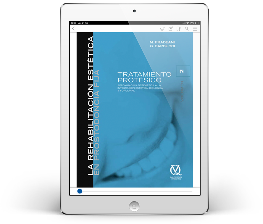 Rehabilitación Estética en Prostodoncia Fija: Volumen 2. Tratamiento protésico. Abordaje sistemático a la integración estética, biológica y funcional