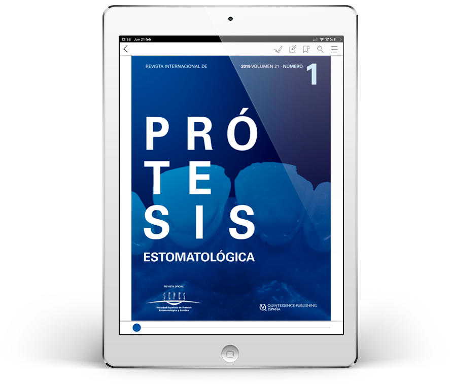 Revista Internacional de Prótesis Estomatológica