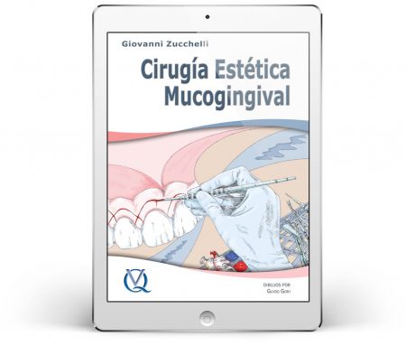 Cirugía Estética Mucogingival