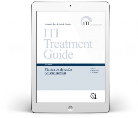 ITI Treatment Guide – Volume 5