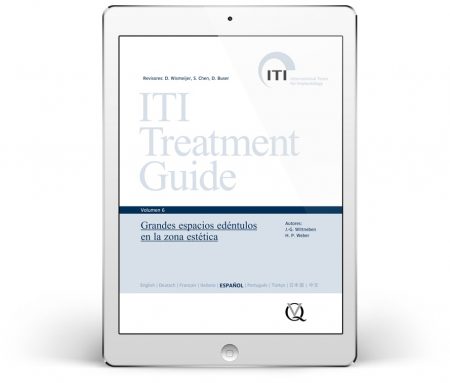 ITI Treatment Guide – Volume 6